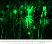 Neuronas hipocampales infectadas
